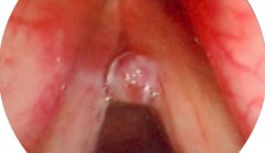 ����Ϣ�⻼�ߵ���ʳ����